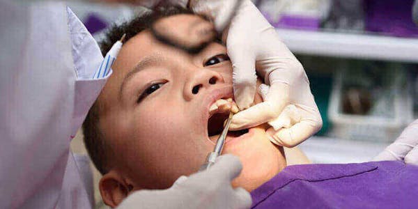 Tooth Extractions Mississauga