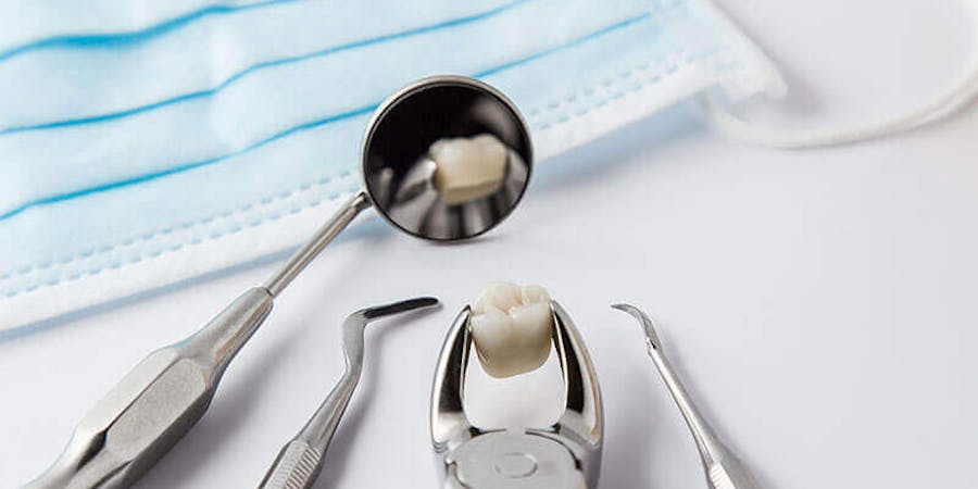 Wisdom Tooth Extraction Mississauga